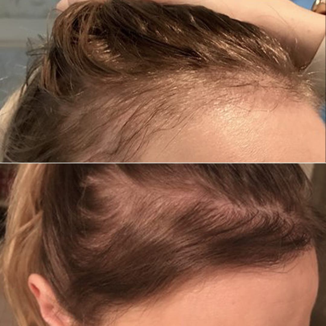 State-of-the-Art Hair Transplant London Clinic in Harley Street