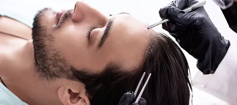 Hair Transplant Turkey – Leading Techniques for Perfect Results
