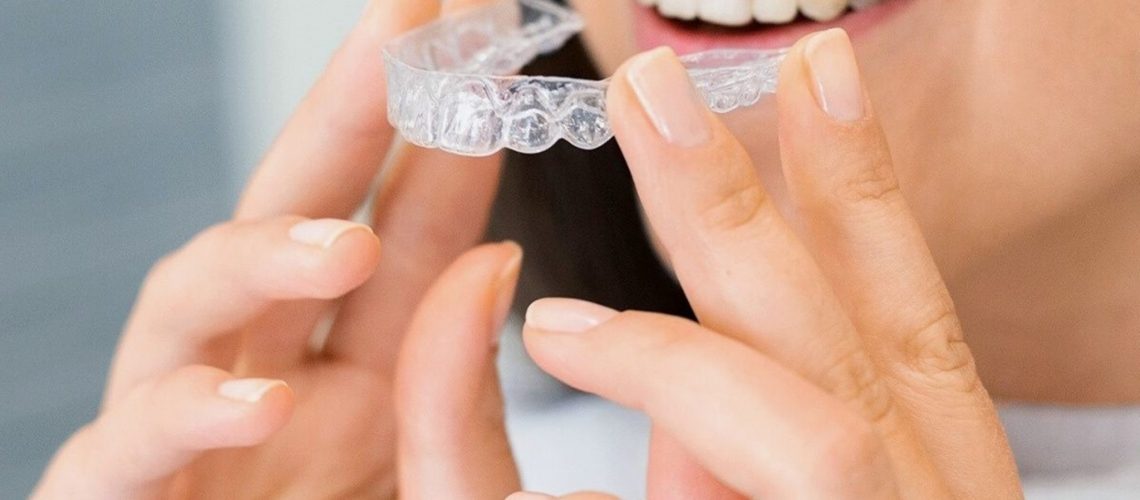 Why Choosing the Best Dental Clinic in Chennai Ensures Optimal Oral Health